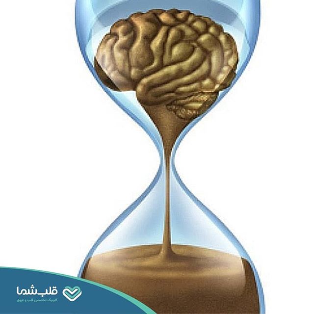 هنگام سکته‌ی مغزی، زمان مساوی با مغز است
